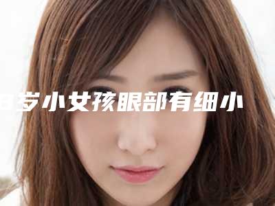 ,8岁小女孩眼部有细小皱纹能办黃瓜,皱纹产生的原因